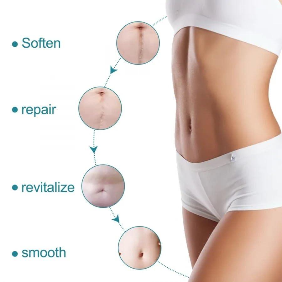 Silicone Gel Sheets – Gentle Scar Reduction Therapy