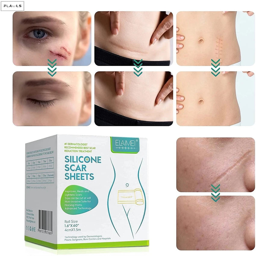 Silicone Gel Sheets – Gentle Scar Reduction Therapy