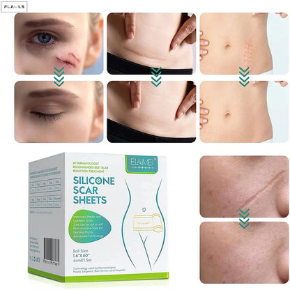 Silicone Gel Sheets – Gentle Scar Reduction Therapy