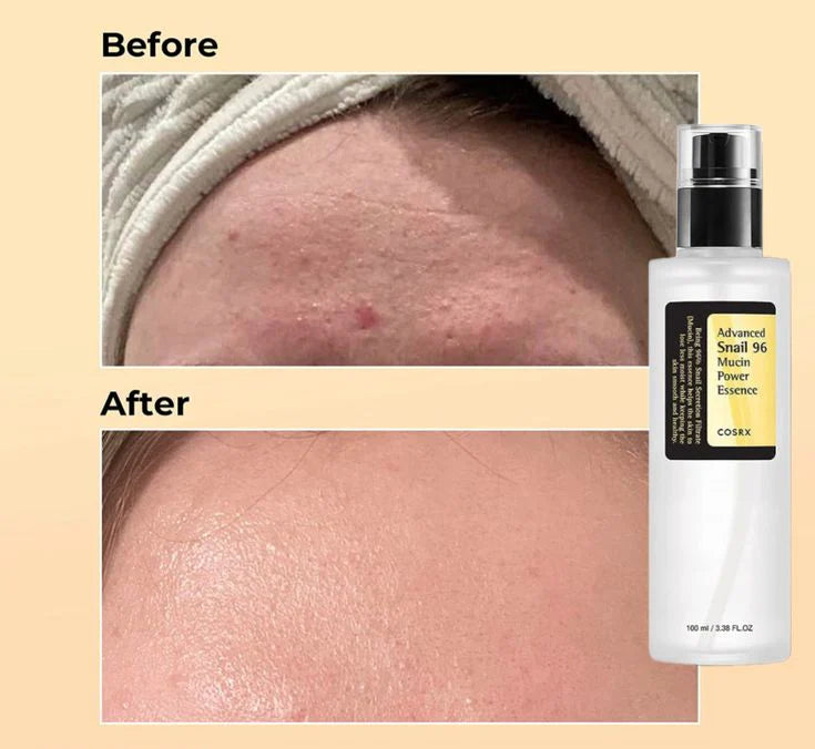 Snail 96 Mucin Power Essence 100 ML (Buy 1 Get 1 Free)