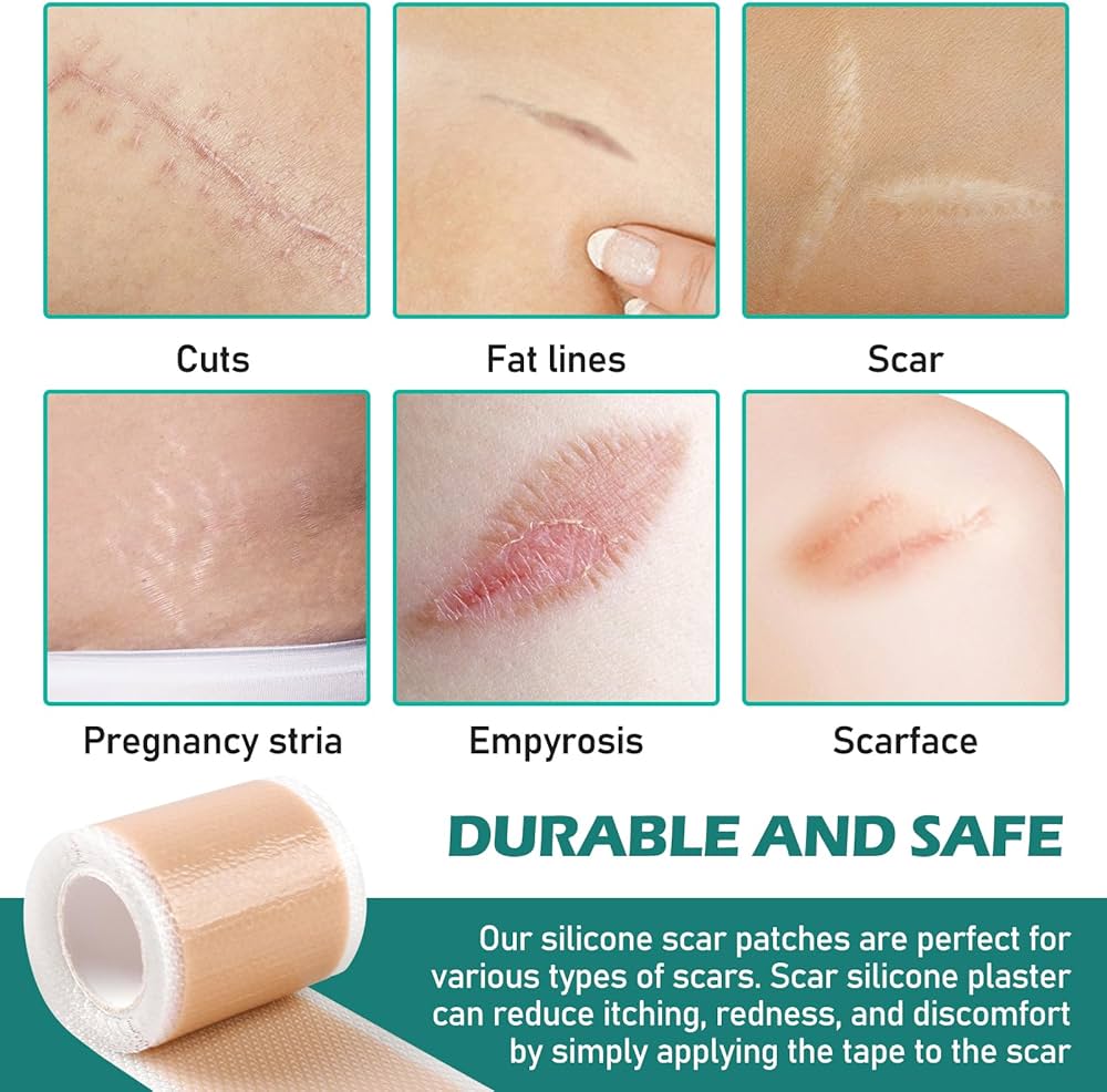 Silicone Gel Sheets – Gentle Scar Reduction Therapy