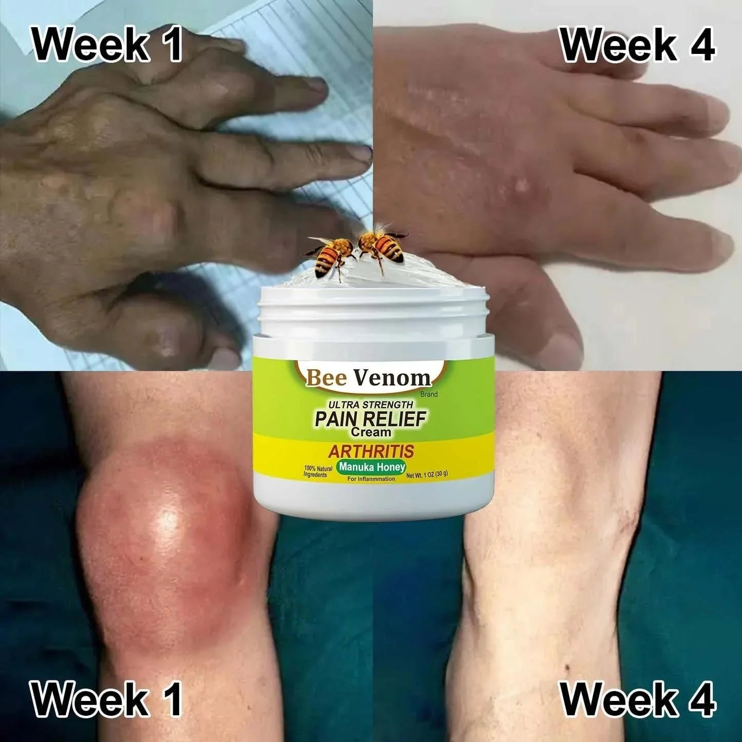 Bee Venom Ultra Strength Pain Relief Cream (Buy 1 Get 1 Free)