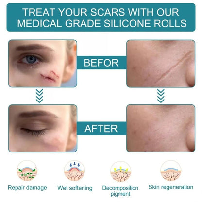 Silicone Gel Sheets – Gentle Scar Reduction Therapy